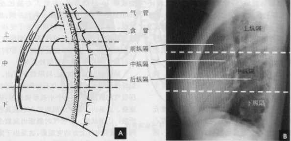 十大曝光胸片：了解肺部健康的重要性与影像学检查的临床应用及其对疾病早期诊断的影响