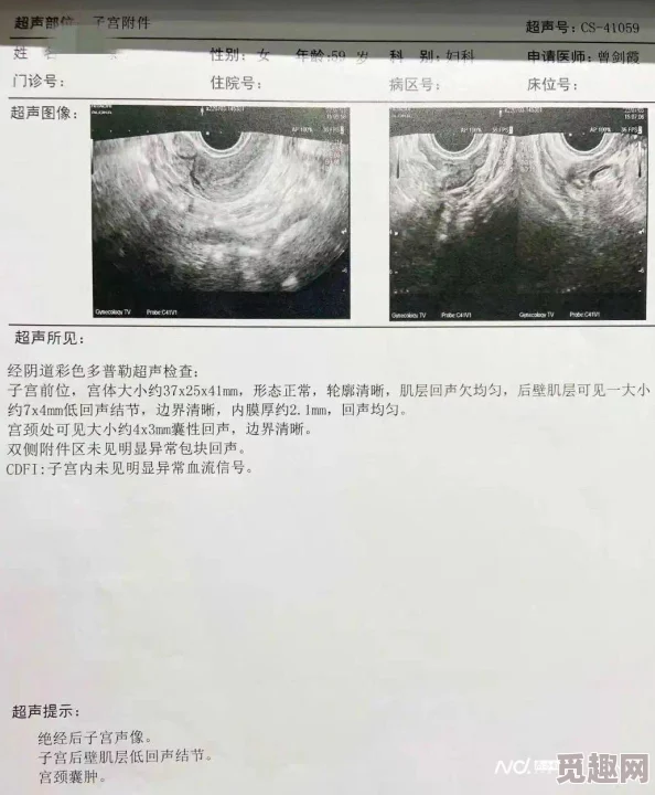 美女私密尿孔18：最新动态显示该视频在社交平台上引发热议，众多网友纷纷评论并分享，引起广泛关注